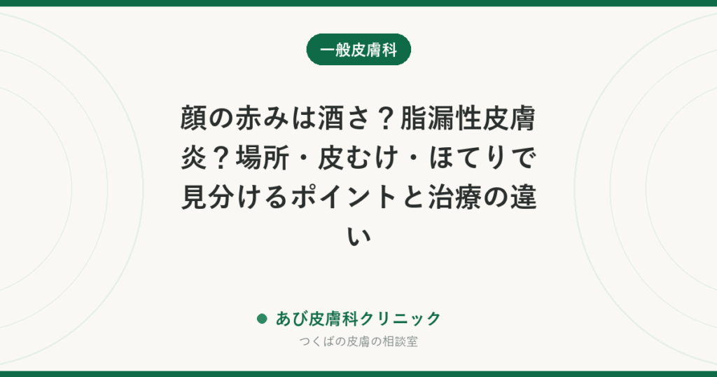 顔の赤みは酒さ？脂漏性皮膚炎？場所・皮むけ・ほてりで見分けるポイントと治療の違い
