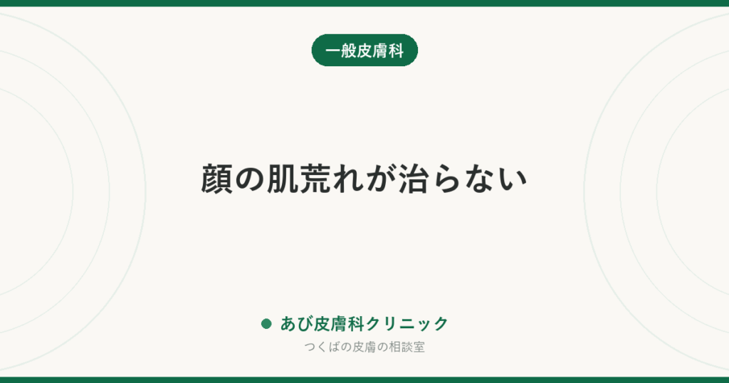 顔の肌荒れが治らない｜乾燥・ニキビ・かぶれ・脂漏性皮膚炎の見分け方と、スキンケアを見直すコツ