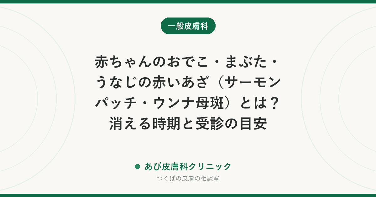 赤ちゃんのおでこ・まぶた・うなじの赤いあざ（サーモンパッチ・ウンナ母斑）とは？消える時期と受診の目安