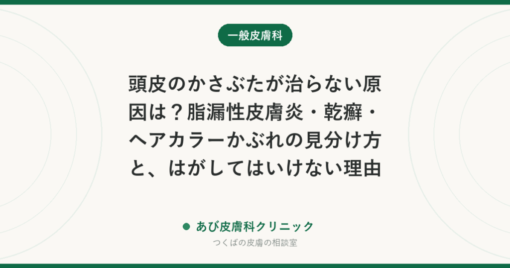頭皮のかさぶたが治らない原因は？脂漏性皮膚炎・乾癬・ヘアカラーかぶれの見分け方と、はがしてはいけない理由