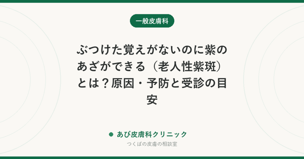 ぶつけた覚えがないのに紫のあざができる（老人性紫斑）とは？原因・予防と受診の目安