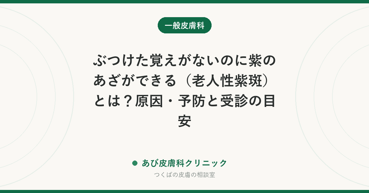 ぶつけた覚えがないのに紫のあざができる（老人性紫斑）とは？原因・予防と受診の目安