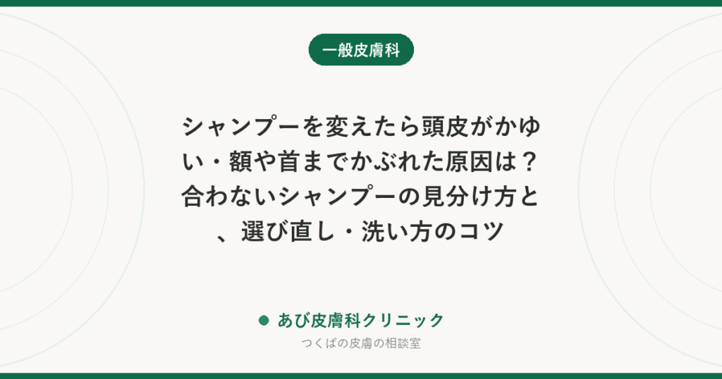 シャンプーを変えたら頭皮がかゆい・額や首までかぶれた原因は？合わないシャンプーの見分け方と、選び直し・洗い方のコツ