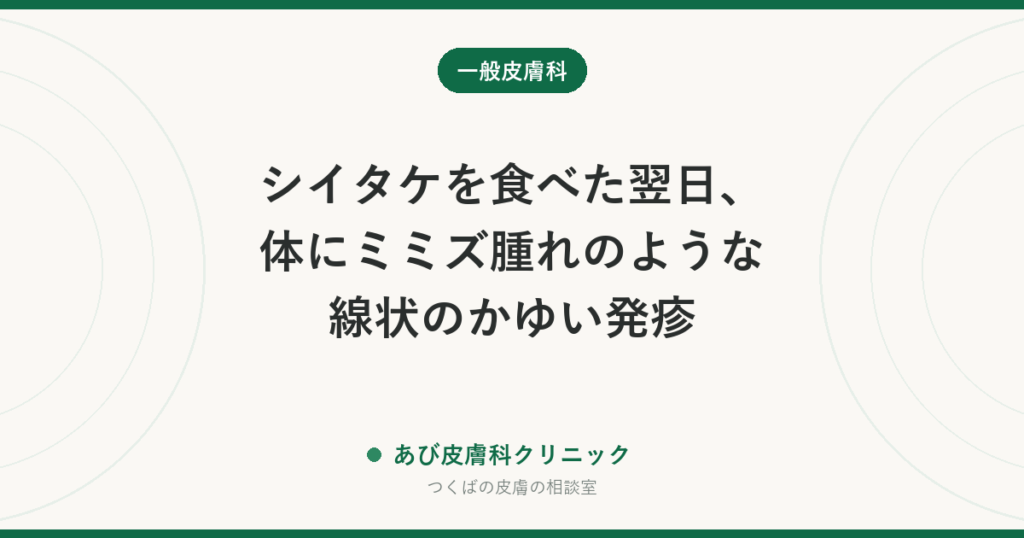 シイタケを食べた翌日、体にミミズ腫れのような線状のかゆい発疹｜シイタケ皮膚炎とは？原因・治るまでの期間と予防