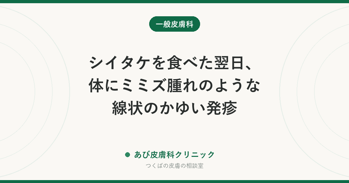 シイタケを食べた翌日、体にミミズ腫れのような線状のかゆい発疹｜シイタケ皮膚炎とは？原因・治るまでの期間と予防