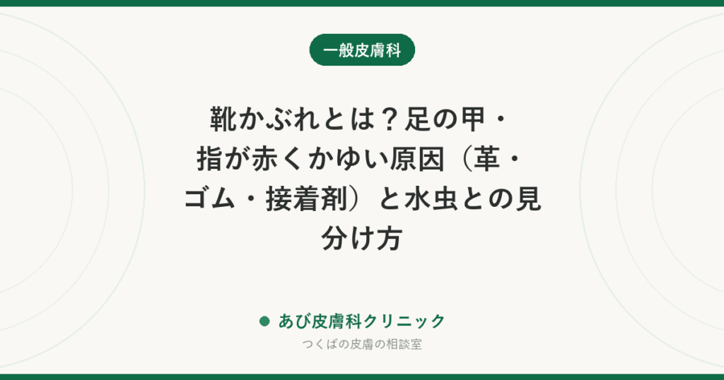 靴かぶれとは？足の甲・指が赤くかゆい原因（革・ゴム・接着剤）と水虫との見分け方