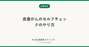 皮膚がんのセルフチェックのやり方｜全身のどこを・何を見る？ほくろ以外のサインと受診の目安