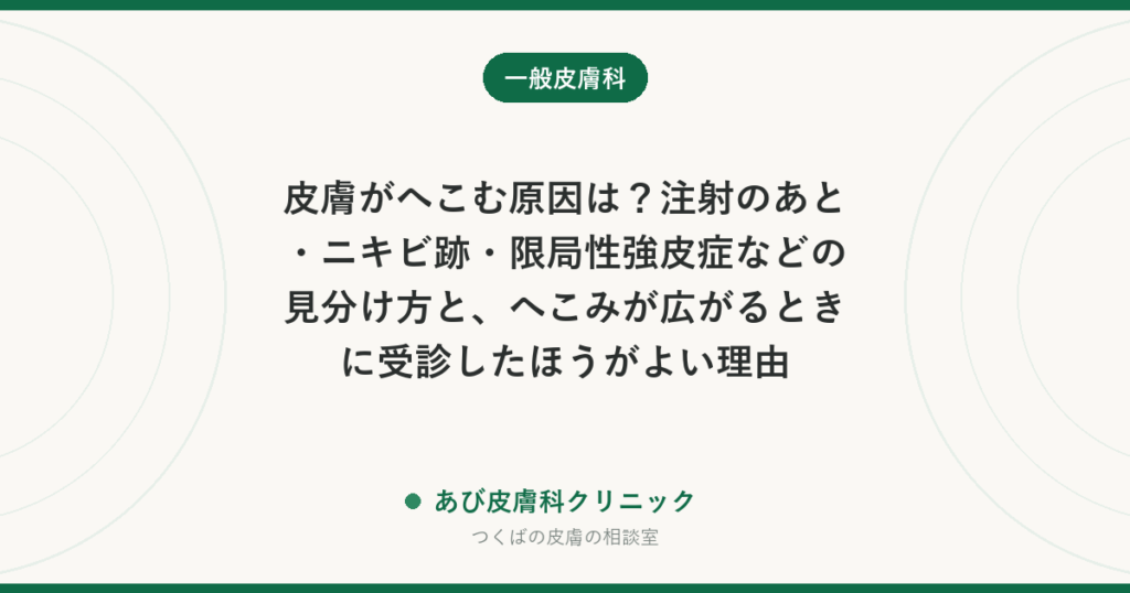 皮膚がへこむ原因は？注射のあと・ニキビ跡・限局性強皮症などの見分け方と、へこみが広がるときに受診したほうがよい理由