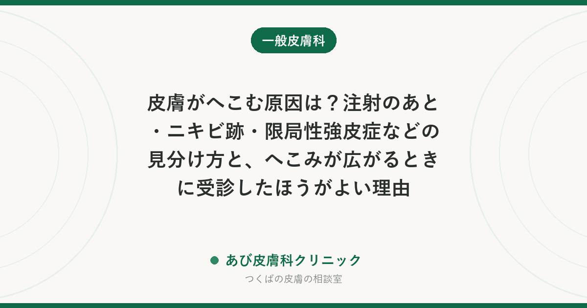 皮膚がへこむ原因は？注射のあと・ニキビ跡・限局性強皮症などの見分け方と、へこみが広がるときに受診したほうがよい理由