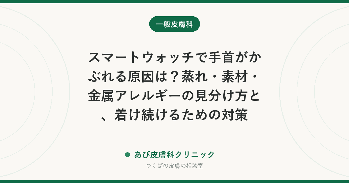 スマートウォッチで手首がかぶれる原因は？蒸れ・素材・金属アレルギーの見分け方と、着け続けるための対策