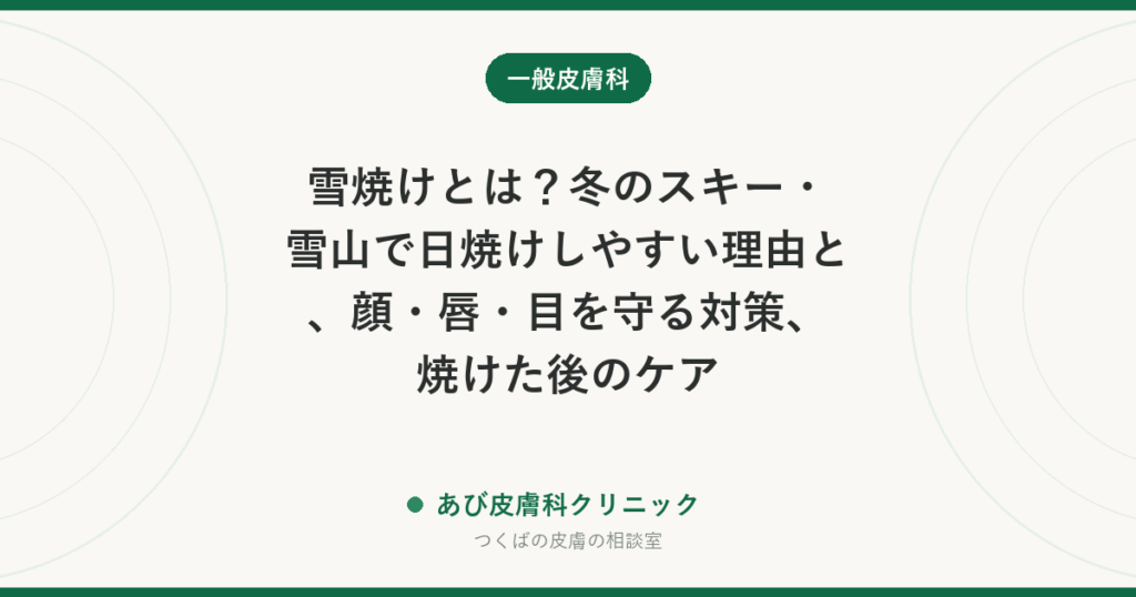 雪焼けとは？冬のスキー・雪山で日焼けしやすい理由と、顔・唇・目を守る対策、焼けた後のケア