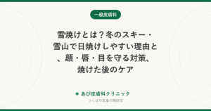 雪焼けとは？冬のスキー・雪山で日焼けしやすい理由と、顔・唇・目を守る対策、焼けた後のケア