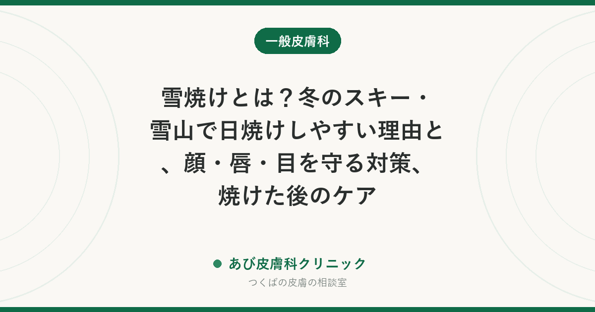 雪焼けとは？冬のスキー・雪山で日焼けしやすい理由と、顔・唇・目を守る対策、焼けた後のケア