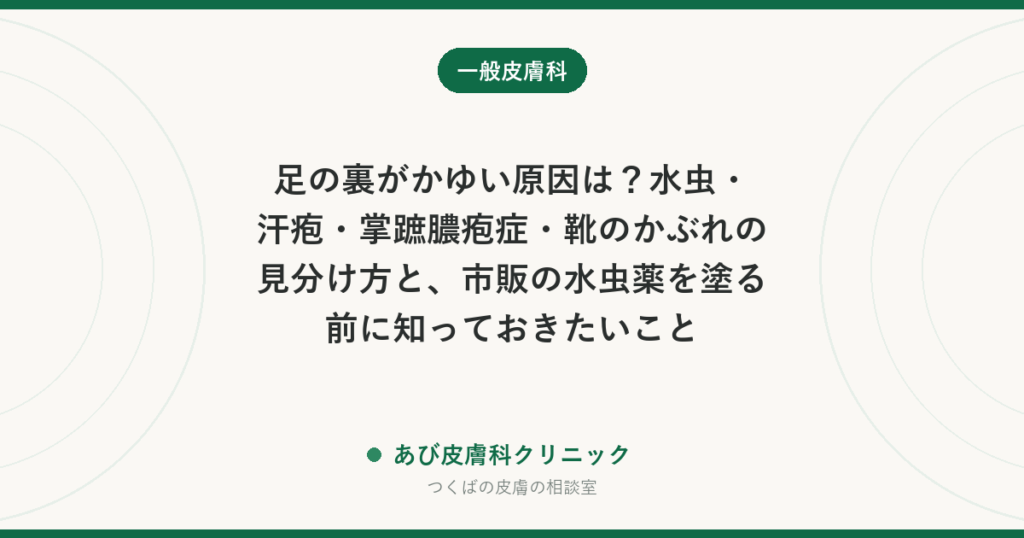 足の裏がかゆい原因は？水虫・汗疱・掌蹠膿疱症・靴のかぶれの見分け方と、市販の水虫薬を塗る前に知っておきたいこと