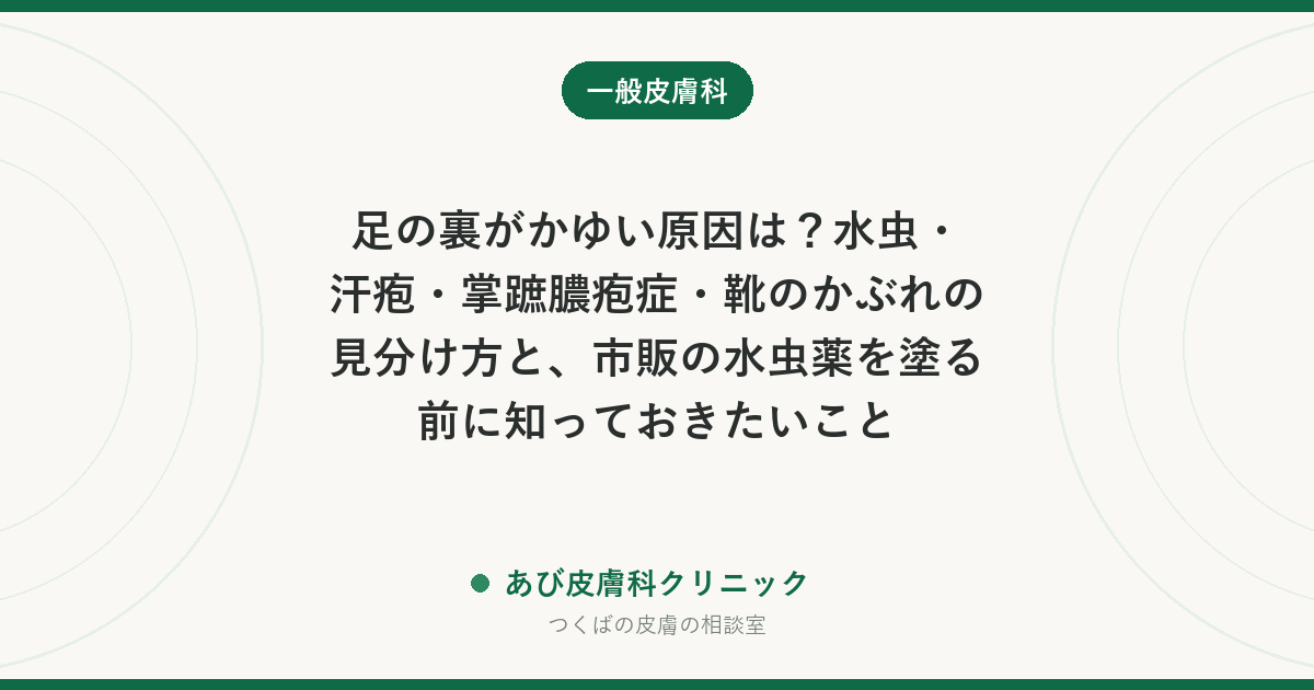足の裏がかゆい原因は？水虫・汗疱・掌蹠膿疱症・靴のかぶれの見分け方と、市販の水虫薬を塗る前に知っておきたいこと