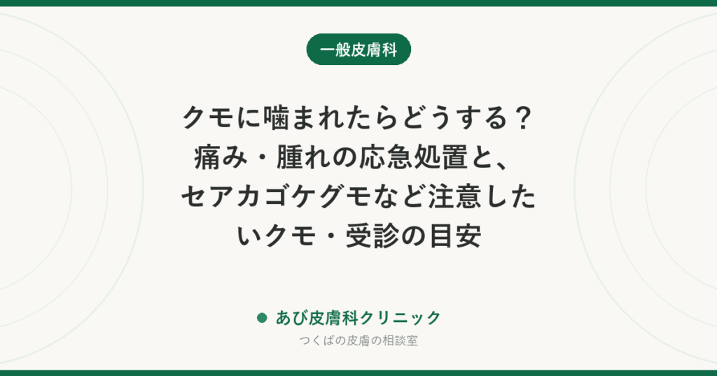 クモに噛まれたらどうする？痛み・腫れの応急処置と、セアカゴケグモなど注意したいクモ・受診の目安
