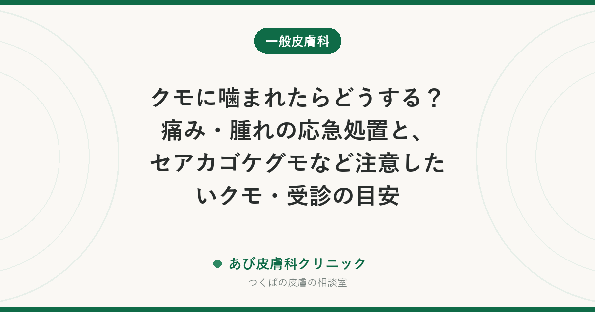 クモに噛まれたらどうする？痛み・腫れの応急処置と、セアカゴケグモなど注意したいクモ・受診の目安