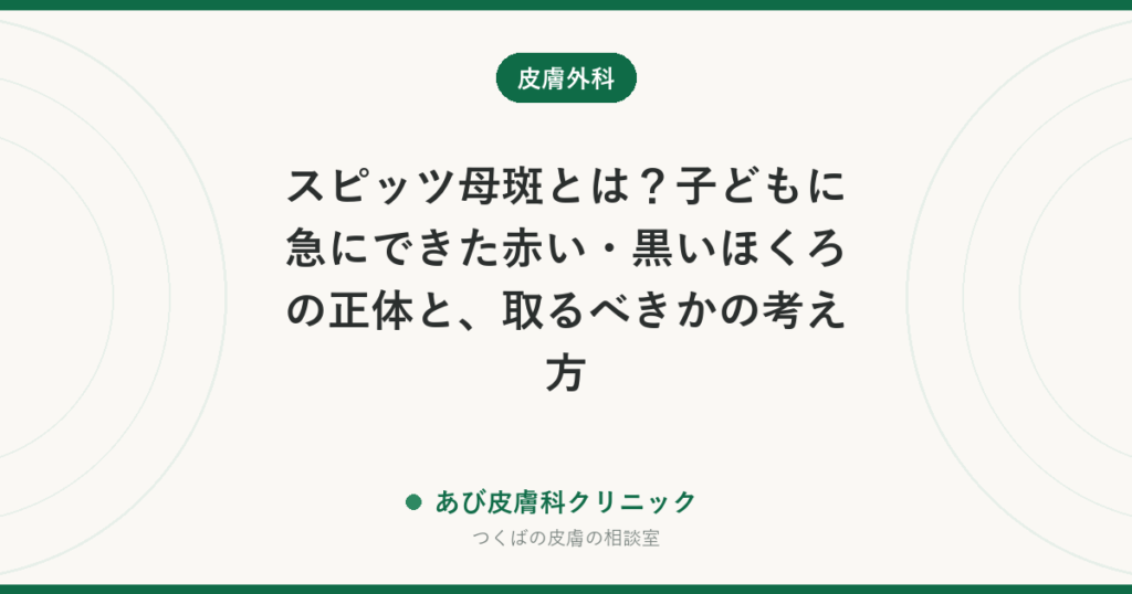 スピッツ母斑とは？子どもに急にできた赤い・黒いほくろの正体と、取るべきかの考え方