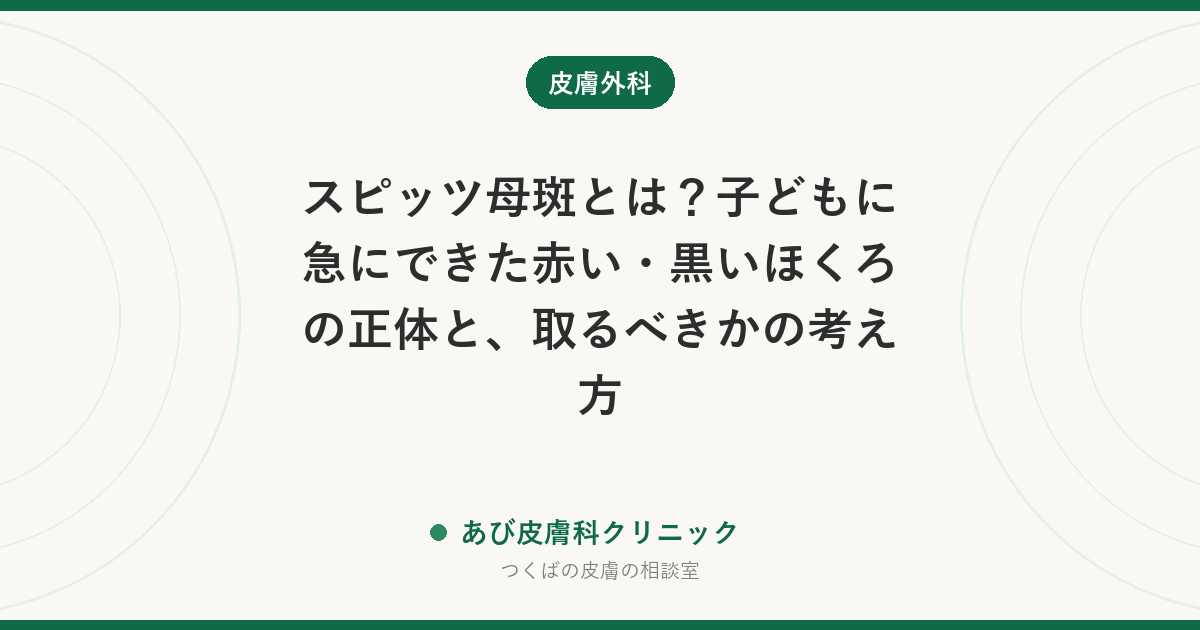 スピッツ母斑とは？子どもに急にできた赤い・黒いほくろの正体と、取るべきかの考え方