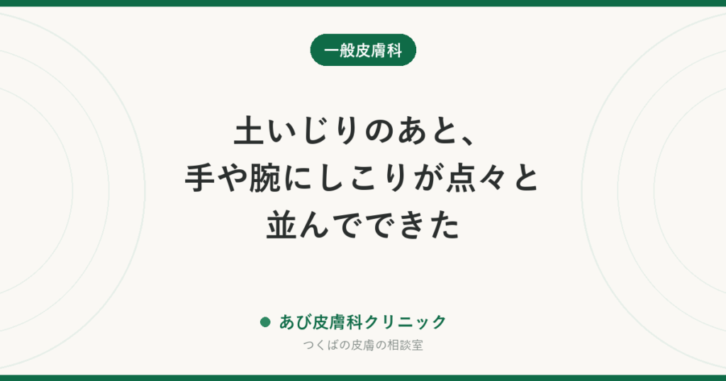 土いじりのあと、手や腕にしこりが点々と並んでできた｜スポロトリコーシスとは？カビが原因の皮膚のしこりと治し方
