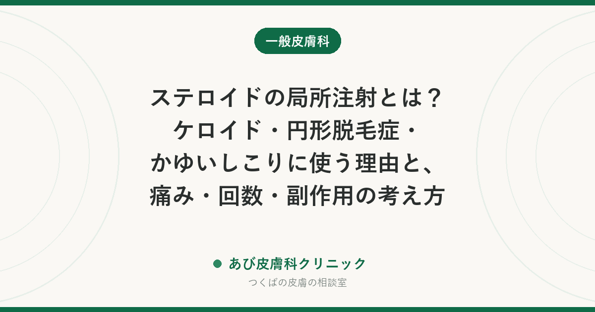 ステロイドの局所注射とは？ケロイド・円形脱毛症・かゆいしこりに使う理由と、痛み・回数・副作用の考え方