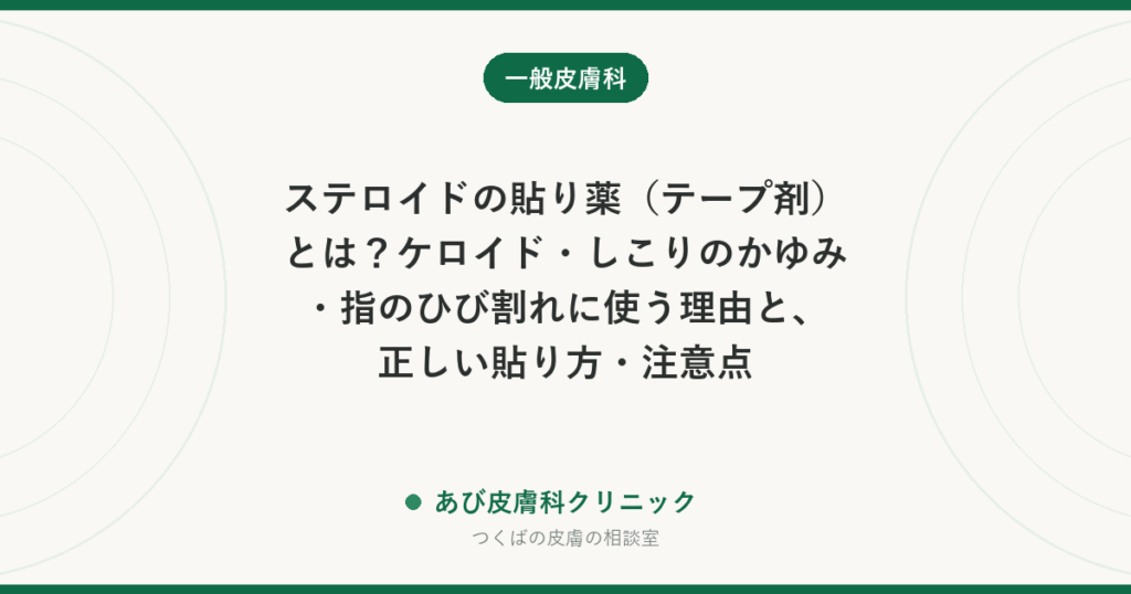 ステロイドの貼り薬（テープ剤）とは？ケロイド・しこりのかゆみ・指のひび割れに使う理由と、正しい貼り方・注意点