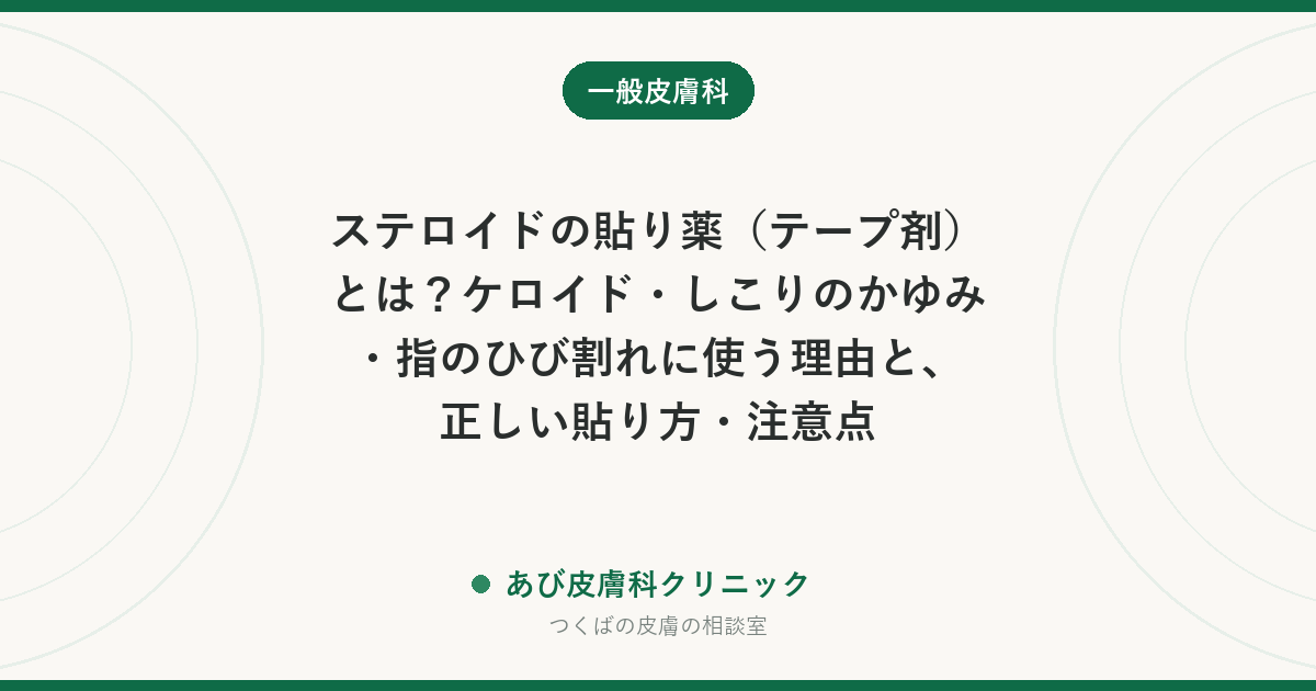 ステロイドの貼り薬（テープ剤）とは？ケロイド・しこりのかゆみ・指のひび割れに使う理由と、正しい貼り方・注意点