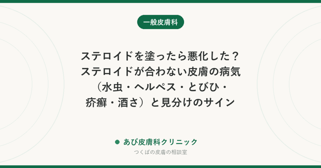 ステロイドを塗ったら悪化した？ステロイドが合わない皮膚の病気（水虫・ヘルペス・とびひ・疥癬・酒さ）と見分けのサイン