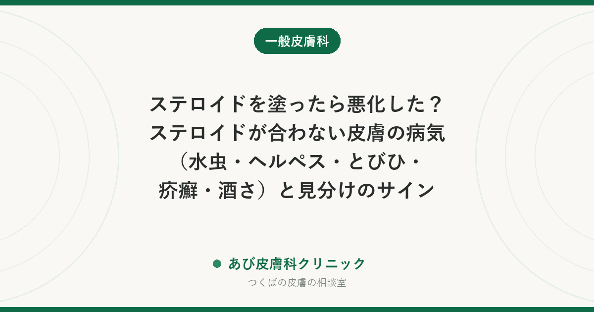 ステロイドを塗ったら悪化した？ステロイドが合わない皮膚の病気（水虫・ヘルペス・とびひ・疥癬・酒さ）と見分けのサイン