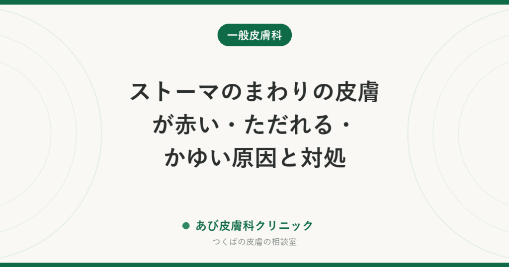 ストーマのまわりの皮膚が赤い・ただれる・かゆい原因と対処｜装具・排泄物・カビの見分け方