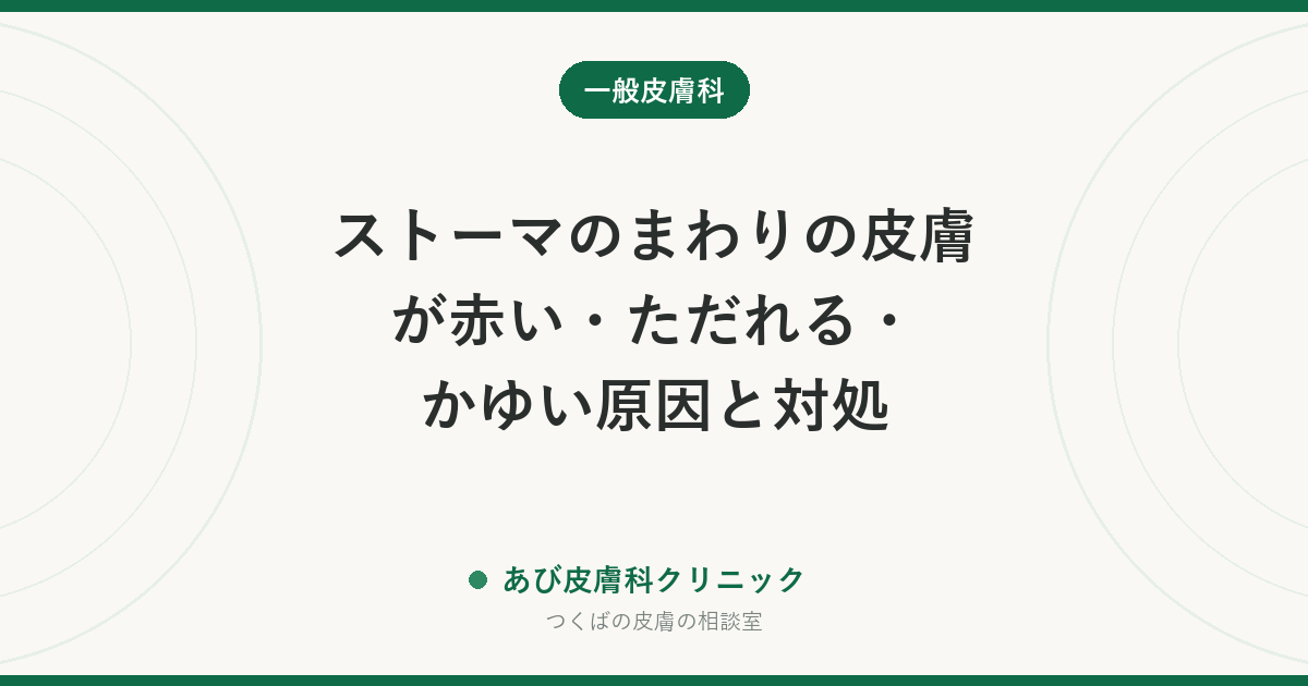 ストーマのまわりの皮膚が赤い・ただれる・かゆい原因と対処｜装具・排泄物・カビの見分け方