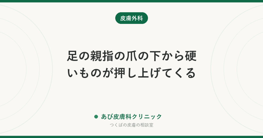 足の親指の爪の下から硬いものが押し上げてくる｜爪下外骨腫とは？巻き爪・イボとの違いと治療