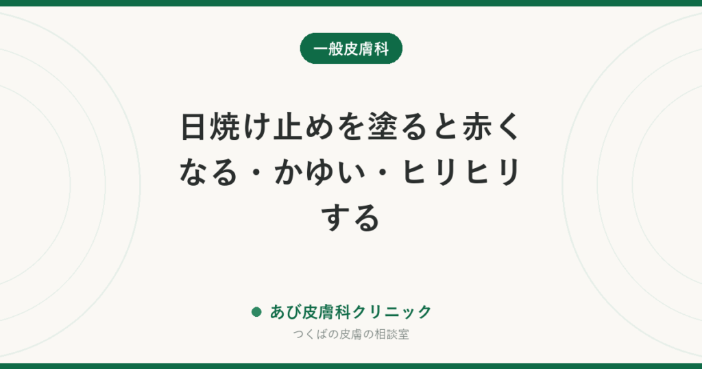 日焼け止めを塗ると赤くなる・かゆい・ヒリヒリする｜日焼け止めかぶれの原因と選び直し方