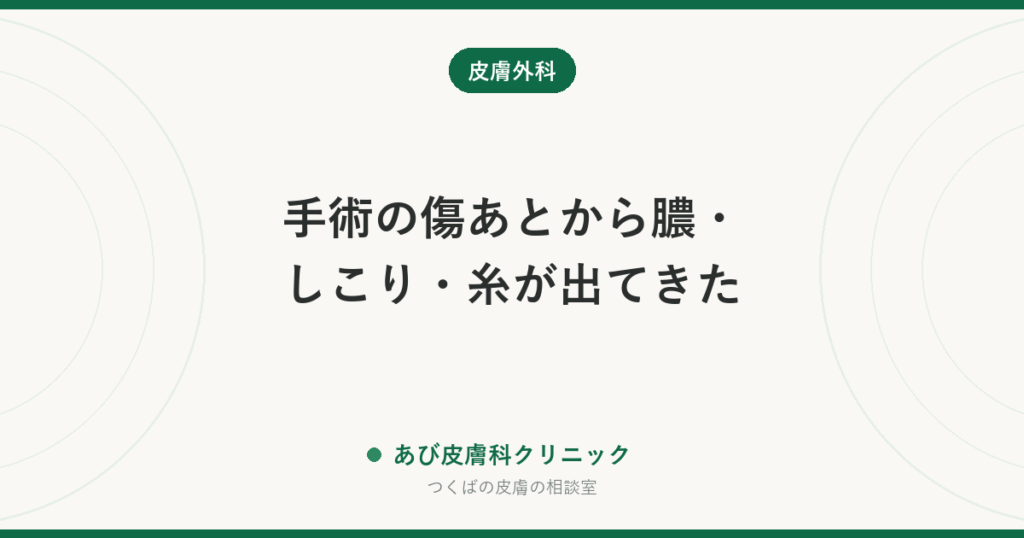 手術の傷あとから膿・しこり・糸が出てきた｜縫合糸膿瘍（ほうごうしのうよう）とは？原因と受診の目安