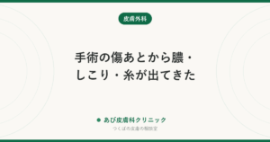 手術の傷あとから膿・しこり・糸が出てきた｜縫合糸膿瘍（ほうごうしのうよう）とは？原因と受診の目安