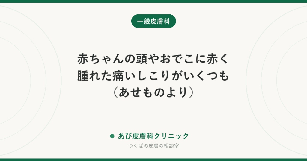 赤ちゃんの頭やおでこに赤く腫れた痛いしこりがいくつも（あせものより）｜あせもとの違い、受診と家庭でのケア