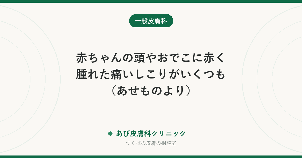 赤ちゃんの頭やおでこに赤く腫れた痛いしこりがいくつも（あせものより）｜あせもとの違い、受診と家庭でのケア