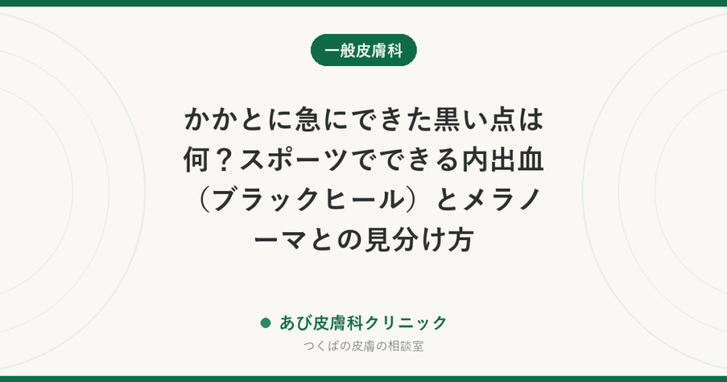 かかとに急にできた黒い点は何？スポーツでできる内出血（ブラックヒール）とメラノーマとの見分け方