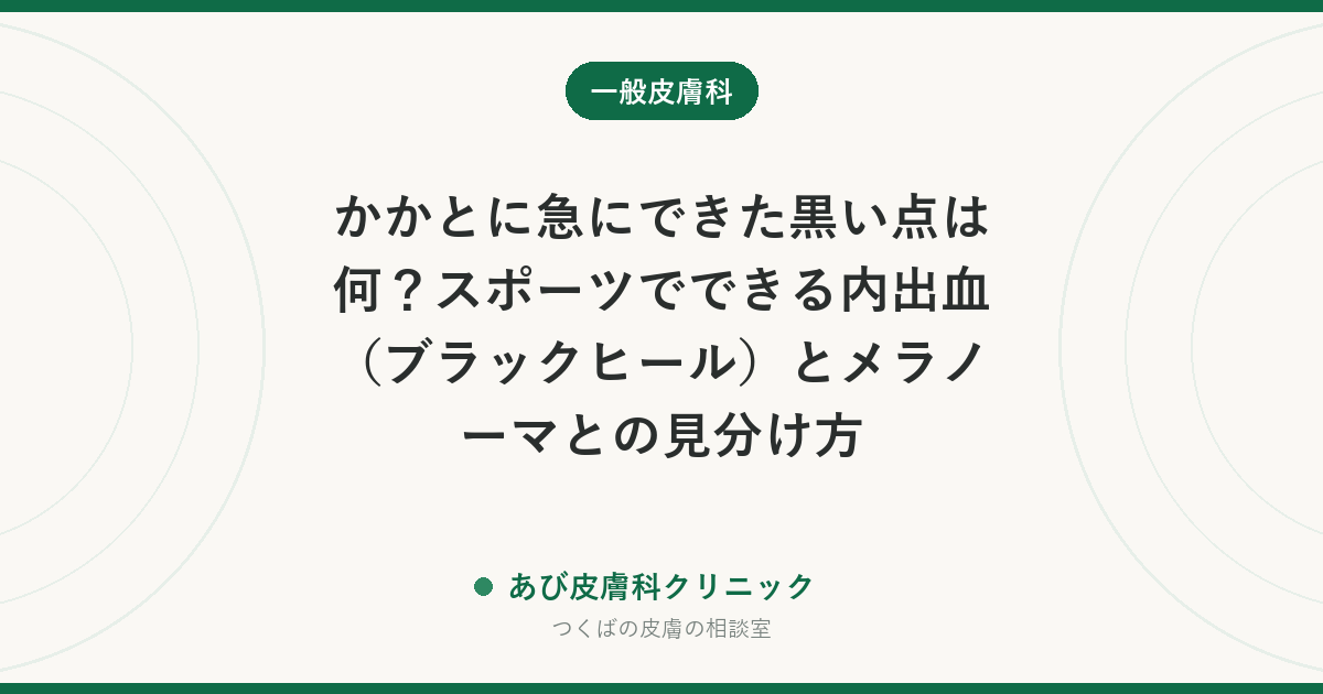 かかとに急にできた黒い点は何？スポーツでできる内出血（ブラックヒール）とメラノーマとの見分け方