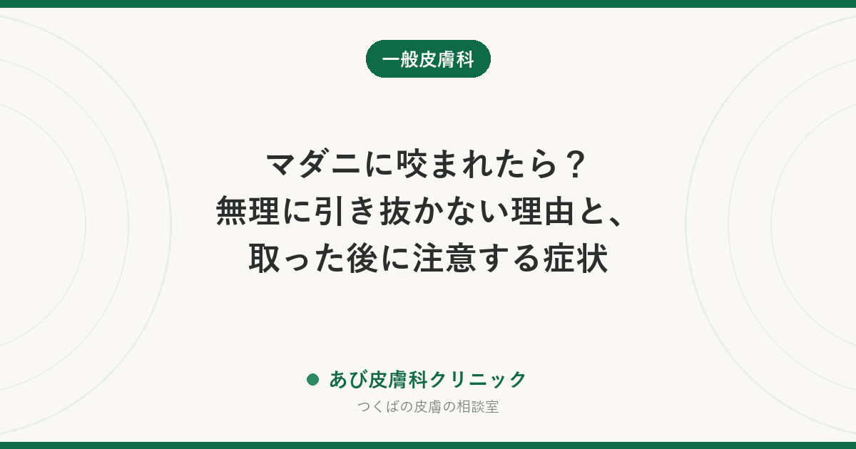 マダニに咬まれたら？無理に引き抜かない理由と、取った後に注意する症状