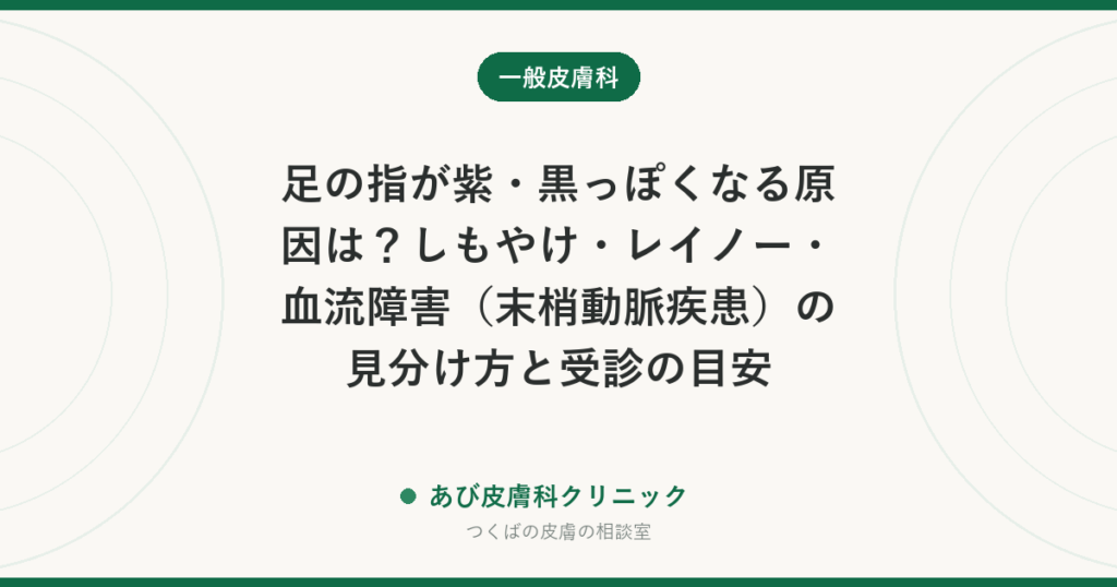 足の指が紫・黒っぽくなる原因は？しもやけ・レイノー・血流障害（末梢動脈疾患）の見分け方と受診の目安