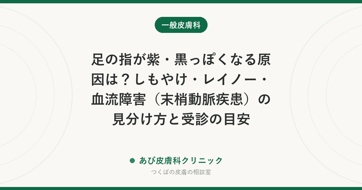 足の指が紫・黒っぽくなる原因は？しもやけ・レイノー・血流障害（末梢動脈疾患）の見分け方と受診の目安