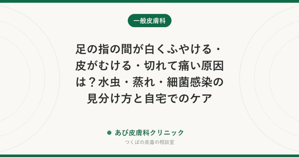 足の指の間が白くふやける・皮がむける・切れて痛い原因は？水虫・蒸れ・細菌感染の見分け方と自宅でのケア