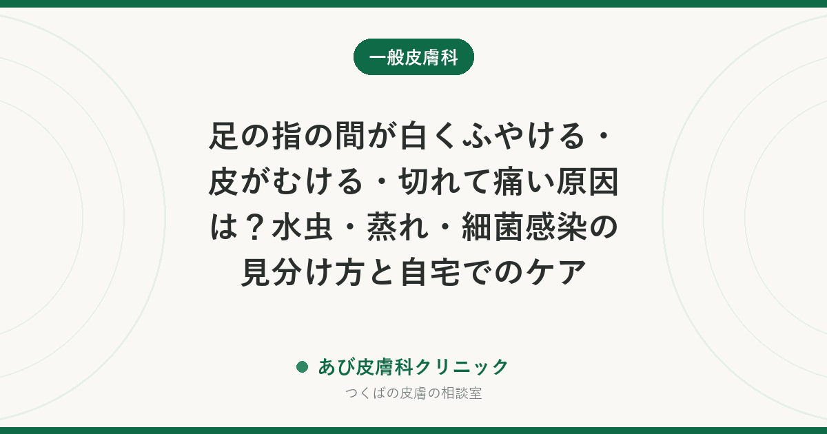 足の指の間が白くふやける・皮がむける・切れて痛い原因は？水虫・蒸れ・細菌感染の見分け方と自宅でのケア