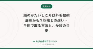 頭のかたいしこりは外毛根鞘嚢腫かも？粉瘤との違い・手術で取る方法と、受診の目安