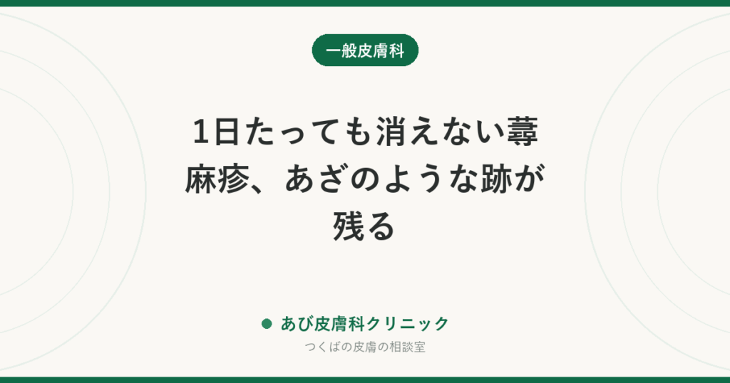 1日たっても消えない蕁麻疹、あざのような跡が残る｜蕁麻疹様血管炎とは？普通の蕁麻疹との見分け方と受診の目安