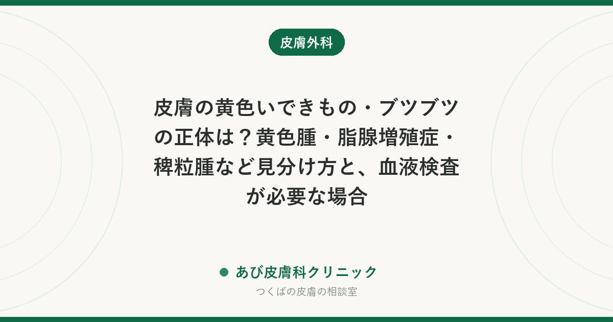 皮膚の黄色いできもの・ブツブツの正体は？黄色腫・脂腺増殖症・稗粒腫など見分け方と、血液検査が必要な場合