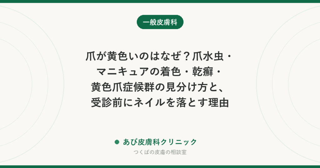 爪が黄色いのはなぜ？爪水虫・マニキュアの着色・乾癬・黄色爪症候群の見分け方と、受診前にネイルを落とす理由