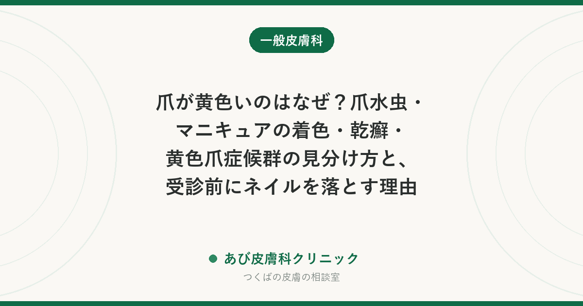 爪が黄色いのはなぜ？爪水虫・マニキュアの着色・乾癬・黄色爪症候群の見分け方と、受診前にネイルを落とす理由